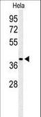 ADP-Ribosylhydrolase Like 2 antibody, LS-C156108, Lifespan Biosciences, Western Blot image 