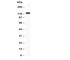 Progesterone Receptor antibody, R30483, NSJ Bioreagents, Western Blot image 