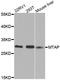 S-methyl-5 -thioadenosine phosphorylase antibody, A1049, ABclonal Technology, Western Blot image 