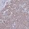 Calcium Release Activated Channel Regulator 2B antibody, NBP1-91863, Novus Biologicals, Immunohistochemistry frozen image 