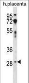 CD200 Molecule antibody, LS-C159303, Lifespan Biosciences, Western Blot image 