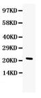 G-CSF antibody, PB9577, Boster Biological Technology, Western Blot image 