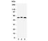 One Cut Homeobox 1 antibody, R31338, NSJ Bioreagents, Western Blot image 