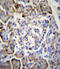 Midkine antibody, LS-C164107, Lifespan Biosciences, Immunohistochemistry paraffin image 
