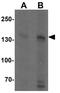 Regulator Of G Protein Signaling 22 antibody, GTX31492, GeneTex, Western Blot image 