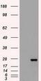 Fms Related Tyrosine Kinase 3 Ligand antibody, GTX84489, GeneTex, Western Blot image 