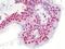 POM121 Transmembrane Nucleoporin antibody, orb178961, Biorbyt, Immunohistochemistry paraffin image 