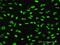 PLAG1 Zinc Finger antibody, H00005324-M07, Novus Biologicals, Immunofluorescence image 