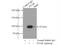 Glycogen Phosphorylase B antibody, 12075-1-AP, Proteintech Group, Immunoprecipitation image 