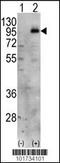 Phosphatidylinositol-4-Phosphate 5-Kinase Type 1 Gamma antibody, 63-359, ProSci, Western Blot image 