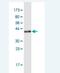 Cancer/Testis Antigen 1B antibody, H00285782-M01-100ug, Novus Biologicals, Western Blot image 