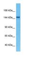 Diphosphoinositol Pentakisphosphate Kinase 1 antibody, orb326449, Biorbyt, Western Blot image 