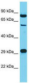 POTE Ankyrin Domain Family Member H antibody, TA332185, Origene, Western Blot image 