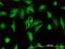 Stress Induced Phosphoprotein 1 antibody, H00010963-M11, Novus Biologicals, Immunofluorescence image 