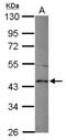 Transmembrane Serine Protease 5 antibody, NBP2-20474, Novus Biologicals, Western Blot image 