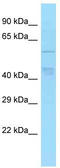 TBC1 Domain Family Member 22A antibody, TA334522, Origene, Western Blot image 