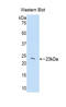 Chromobox 3 antibody, LS-C293327, Lifespan Biosciences, Western Blot image 