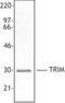 T Cell Receptor Associated Transmembrane Adaptor 1 antibody, LS-C41080, Lifespan Biosciences, Western Blot image 