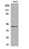 Potassium Voltage-Gated Channel Subfamily A Regulatory Beta Subunit 3 antibody, orb161581, Biorbyt, Western Blot image 