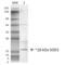 Superoxide Dismutase 1 antibody, 13064, QED Bioscience, Western Blot image 