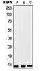 Putative apoptosis inhibitor FKSG2 antibody, orb215612, Biorbyt, Western Blot image 