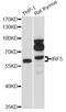 Interferon Regulatory Factor 5 antibody, LS-C748662, Lifespan Biosciences, Western Blot image 