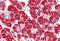 Phosphoinositide-3-Kinase Regulatory Subunit 1 antibody, MBS249089, MyBioSource, Immunohistochemistry paraffin image 