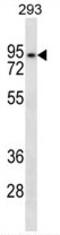 Ankyrin Repeat Domain 6 antibody, AP50190PU-N, Origene, Western Blot image 