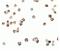 Receptor Interacting Serine/Threonine Kinase 2 antibody, NBP1-76960, Novus Biologicals, Immunofluorescence image 