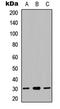 NADH:Ubiquinone Oxidoreductase Core Subunit S3 antibody, LS-C358815, Lifespan Biosciences, Western Blot image 