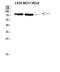 DEAD-Box Helicase 3 X-Linked antibody, STJ92677, St John