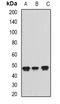 Phosphoribosylaminoimidazole Carboxylase And Phosphoribosylaminoimidazolesuccinocarboxamide Synthase antibody, LS-B16062, Lifespan Biosciences, Western Blot image 