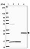 Von Willebrand Factor C Domain Containing 2 antibody, NBP2-33745, Novus Biologicals, Western Blot image 