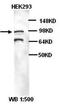 Karyopherin Subunit Beta 1 antibody, orb77176, Biorbyt, Western Blot image 