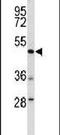 DEK Proto-Oncogene antibody, PA5-26194, Invitrogen Antibodies, Western Blot image 