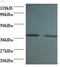 Rho GDP Dissociation Inhibitor Alpha antibody, LS-C211155, Lifespan Biosciences, Western Blot image 