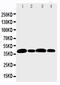 Aurora Kinase B antibody, GTX12105, GeneTex, Western Blot image 