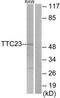 Tetratricopeptide Repeat Domain 23 antibody, TA315752, Origene, Western Blot image 
