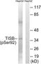 ZFP36 Ring Finger Protein Like 1 antibody, PA5-37500, Invitrogen Antibodies, Western Blot image 