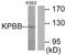 Phosphorylase Kinase Regulatory Subunit Beta antibody, PA5-38757, Invitrogen Antibodies, Western Blot image 