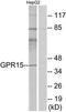 G Protein-Coupled Receptor 15 antibody, TA313941, Origene, Western Blot image 