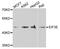 Eukaryotic Translation Initiation Factor 3 Subunit E antibody, A5447, ABclonal Technology, Western Blot image 