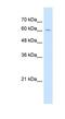 Zona Pellucida Glycoprotein 2 antibody, NBP1-59436, Novus Biologicals, Western Blot image 