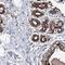 NIMA Related Kinase 1 antibody, HPA040413, Atlas Antibodies, Immunohistochemistry frozen image 