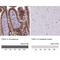 Cadherin 1 antibody, AMAb90863, Atlas Antibodies, Immunohistochemistry frozen image 