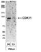 Cyclin Dependent Kinase 11A antibody, NBP1-71798, Novus Biologicals, Western Blot image 