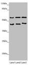 RNA Binding Motif Protein 17 antibody, LS-C676372, Lifespan Biosciences, Western Blot image 