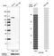 Inositol Polyphosphate-4-Phosphatase Type II B antibody, HPA037682, Atlas Antibodies, Western Blot image 