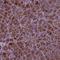 AP-5 complex subunit beta-1 antibody, NBP2-49531, Novus Biologicals, Immunohistochemistry frozen image 