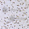 Elongation Factor Tu GTP Binding Domain Containing 2 antibody, A7040, ABclonal Technology, Immunohistochemistry paraffin image 